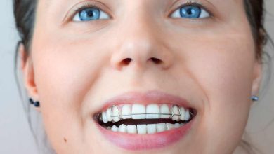 Orthopedic Appliances in Orthodontics: Correcting Skeletal Issues