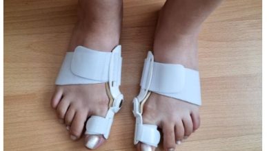 Where to Get the Best Bunion Surgery Near Me